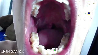 Opening the mouth very wide until the uvula