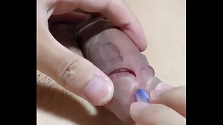 尿道バルーンカテーテルの除去。カテの先端にある一回り太くなったバルーン機構が、前立腺を通過した瞬間ゴリュゴリュッ！と擦られて強烈な快感が…