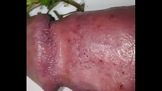 First nettles 2021 for my bruised cock