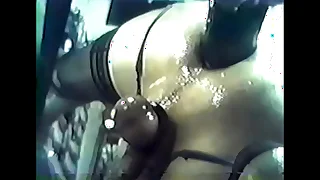 Extreme anal stretching