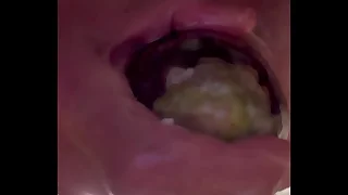 Having it away with 10in wide eggplant with rosebud prolapse