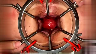 Open my hole with a octopus claw - ornament 1