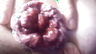 Wet distended exalt opening